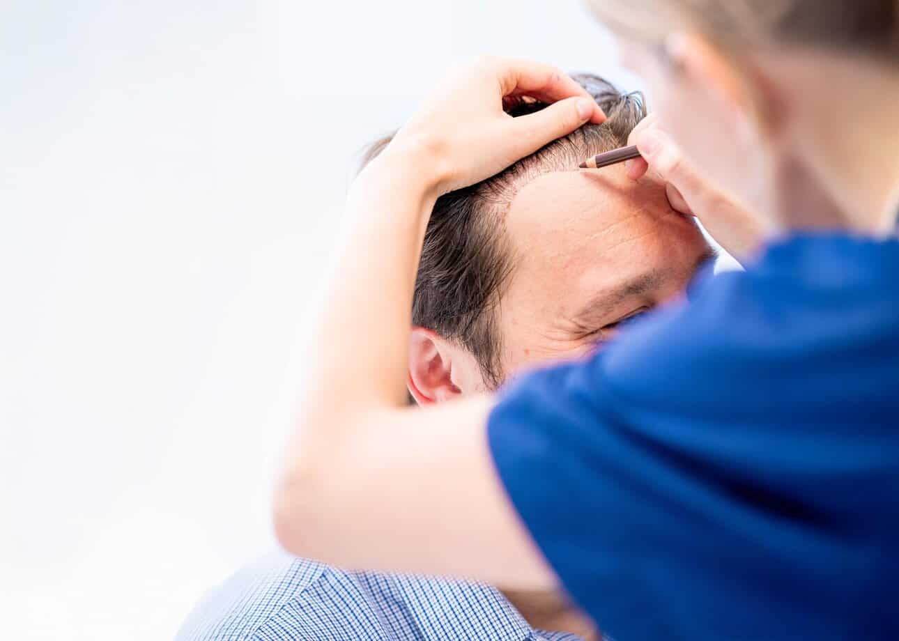 Hair loss in Rotterdam: when a hair transplant makes sense Considering a hair transplant in Rotterdam? Learn about local options, FUE methods, and why Zantman Kliniek is a trusted choice for lasting results.